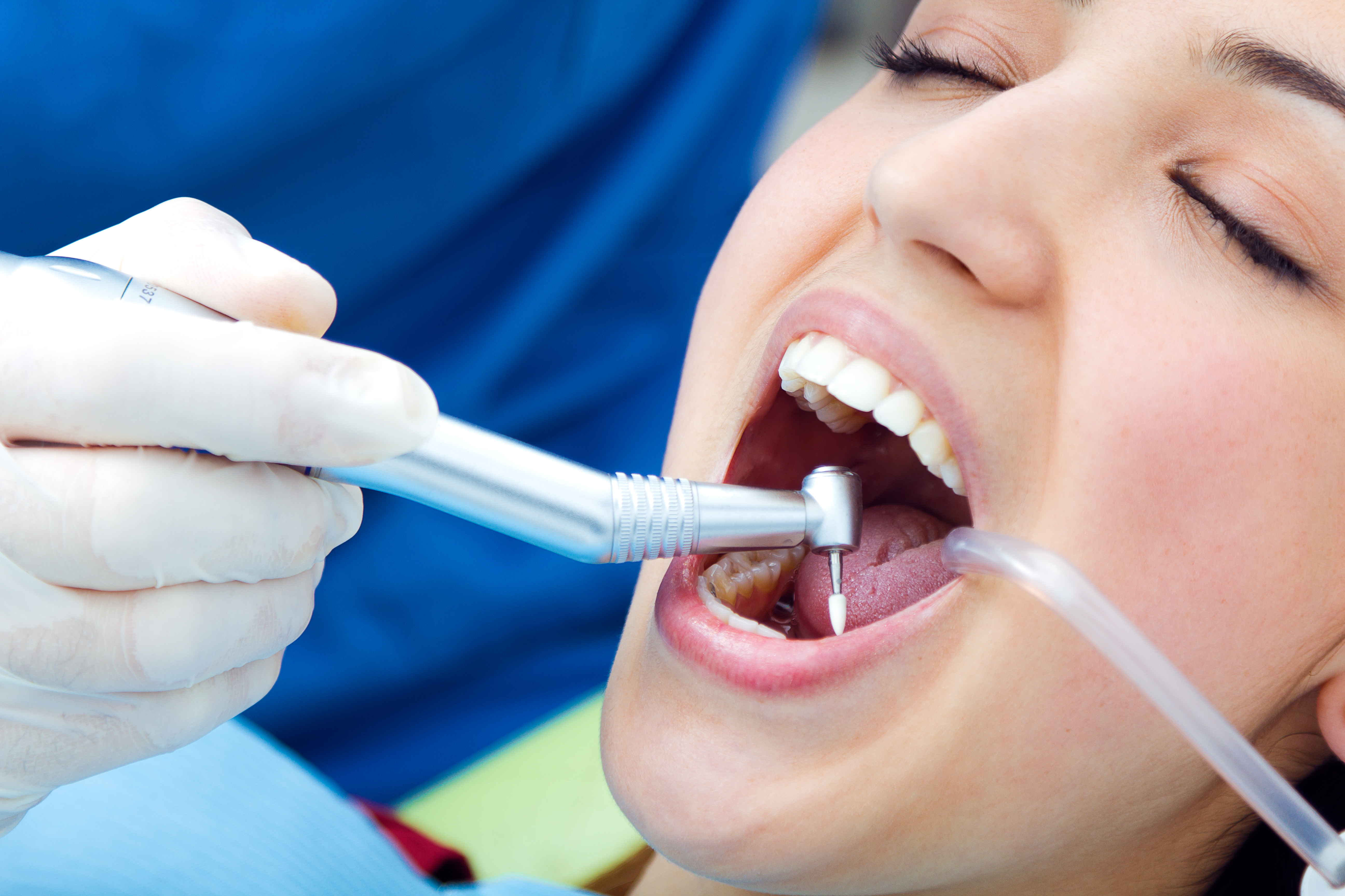 Dental Implants