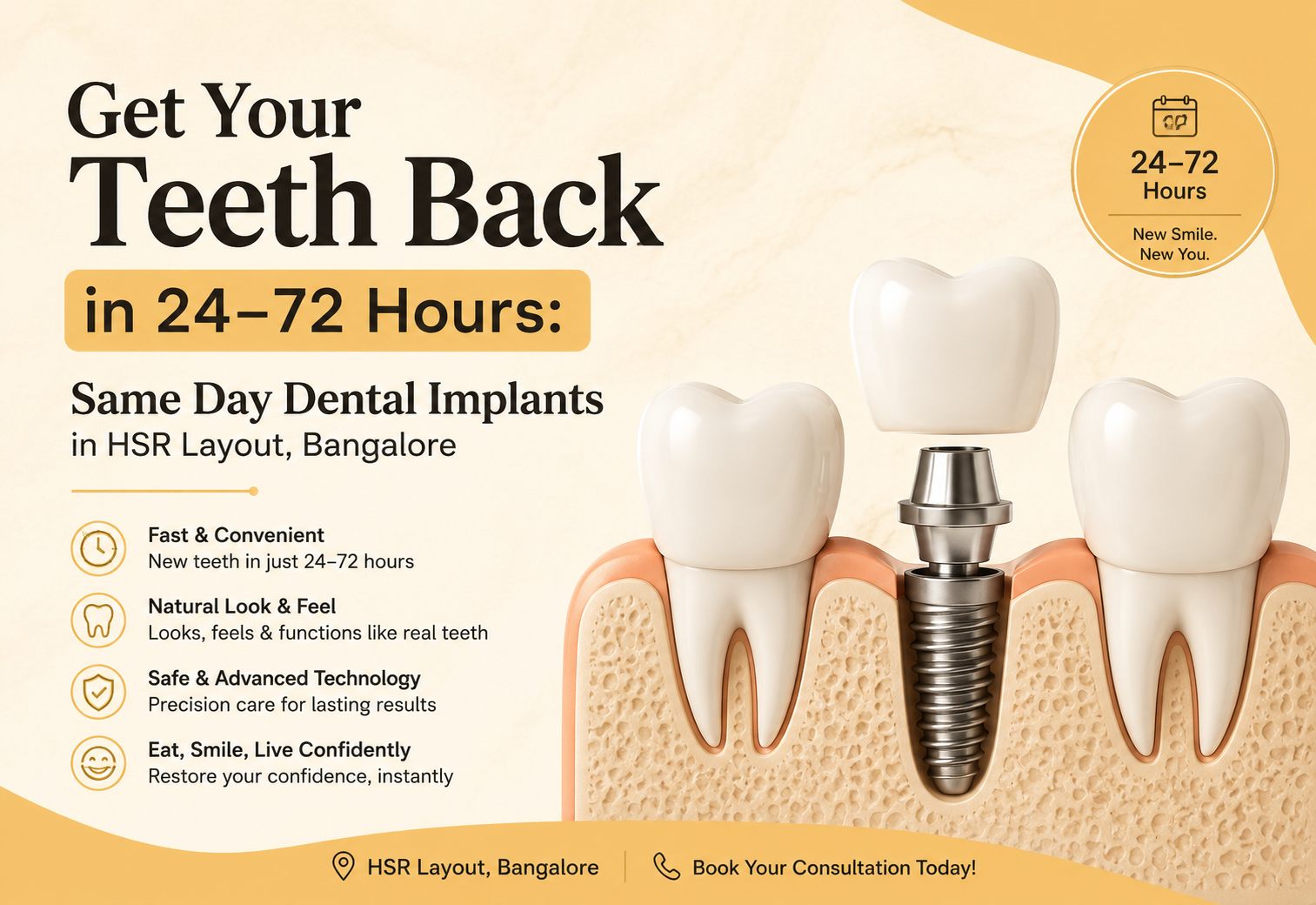 dental implants in HSR Layout