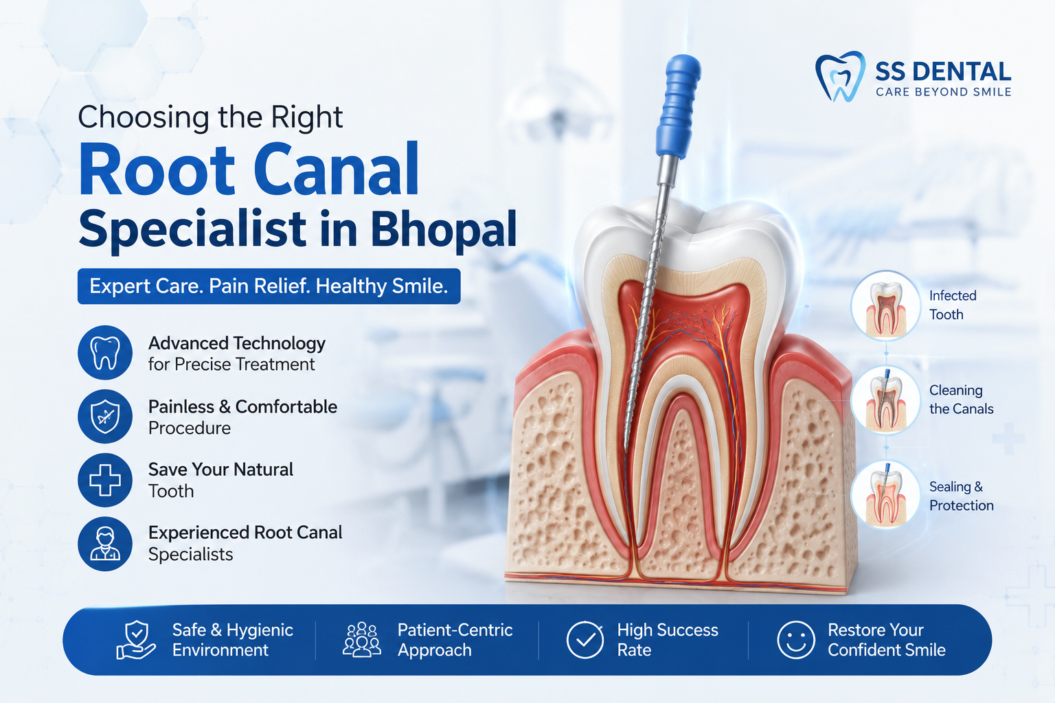 Root canal specialist in Bhopal