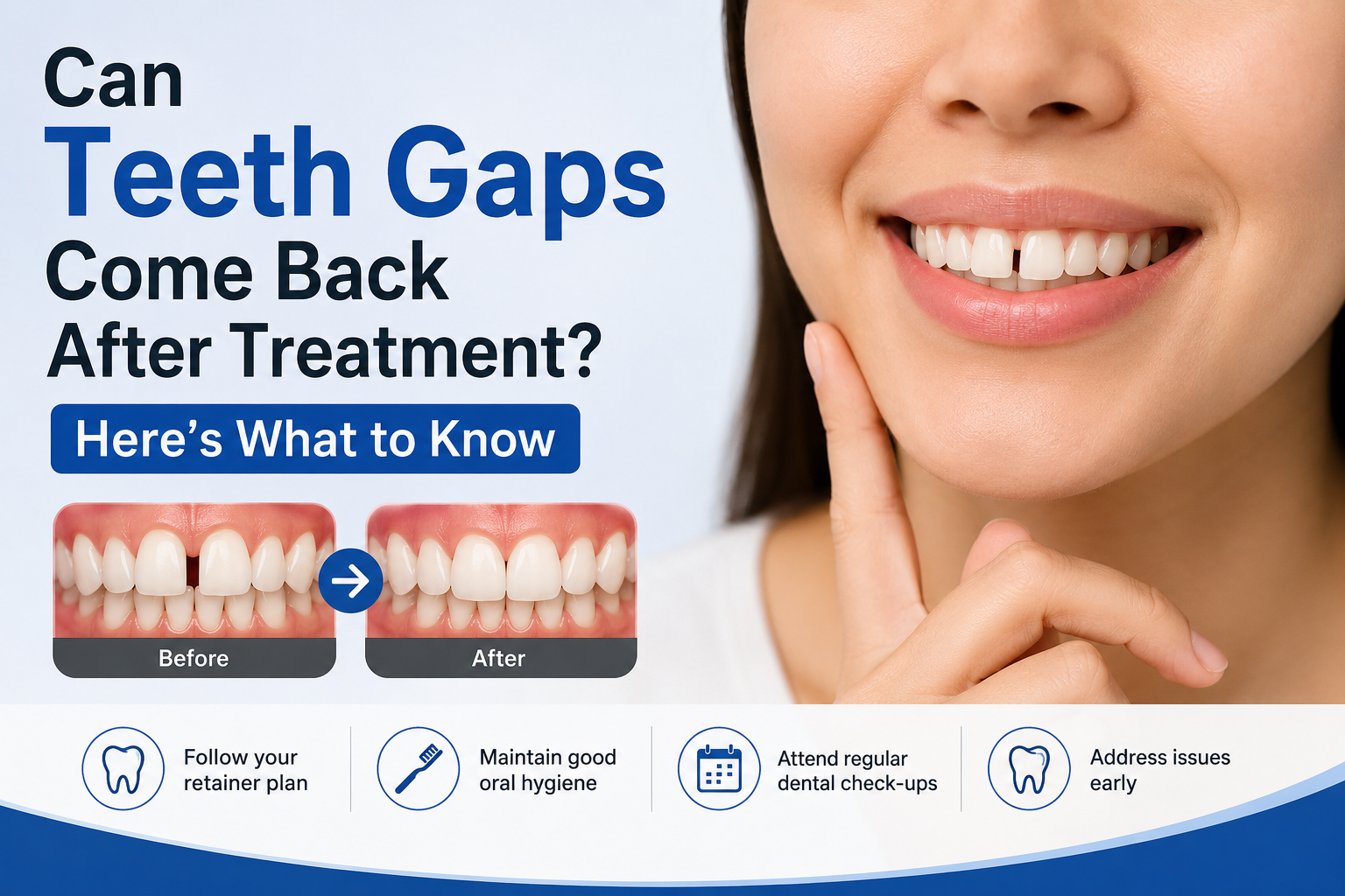 Teeth Spacing Treatment in HSR Layout