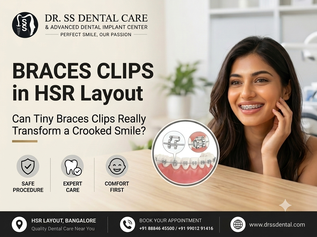 braces clips in hsr layout