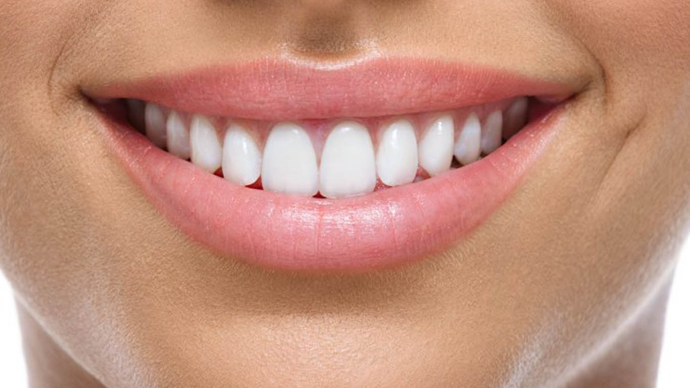 Smile Designing